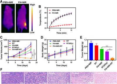 Injectable Hydrogel for Synergetic Low Dose Radiotherapy, Chemodynamic Therapy and Photothermal Therapy